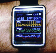 Samsung Simband dos
